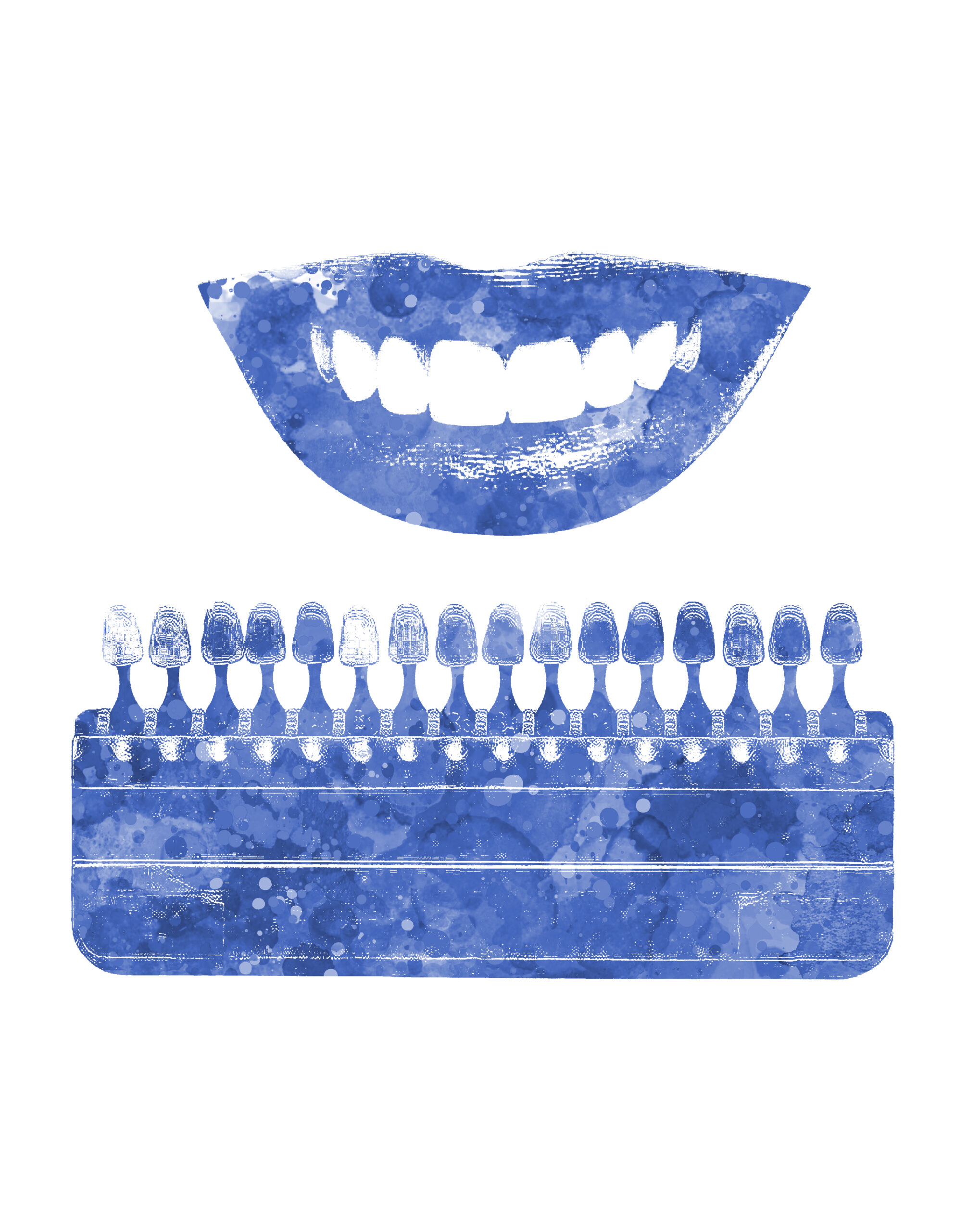 Ein Mund mit gut sichtbaren Zähnen und einer Farbpalette mit verschiedenen Zahnweistönen
